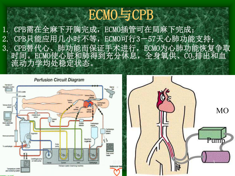 完整版ECMO技术临床应用.ppt课件.ppt_第3页