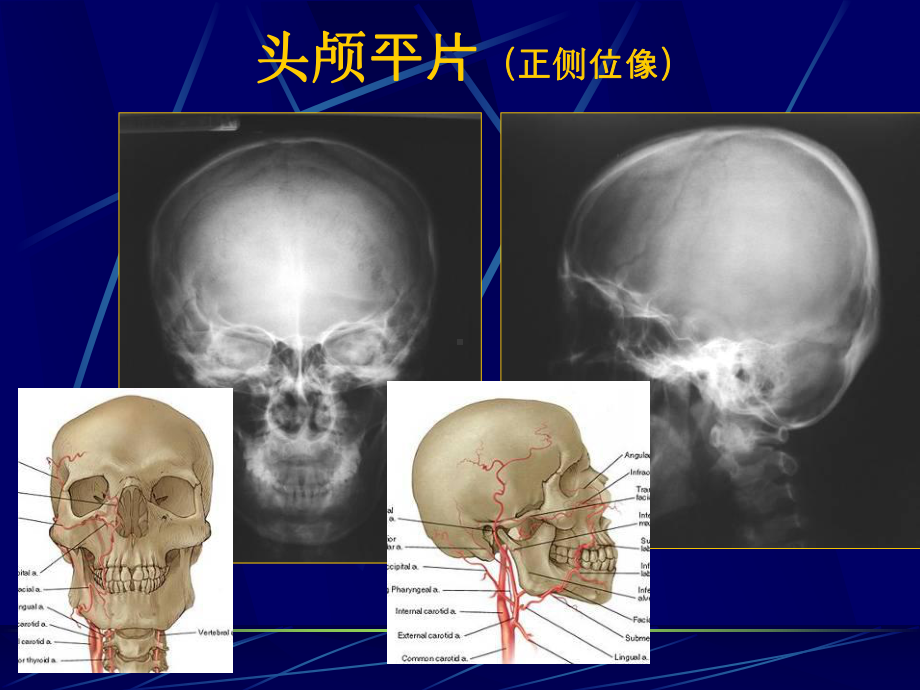 中枢神经系统正常及异常影像改变汇总课件.ppt_第3页