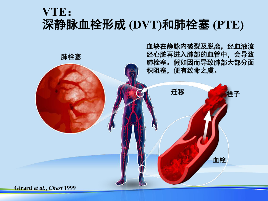 2021年静脉血栓防治解读完整版PPT课件.ppt_第3页