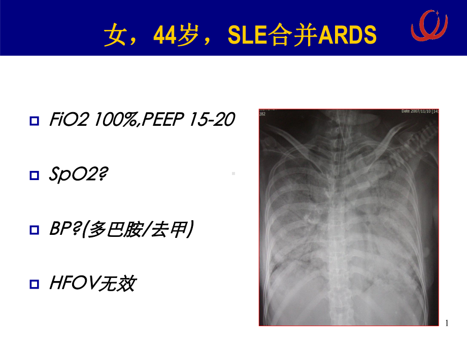 ECMO的安全性ppt课件.ppt_第2页