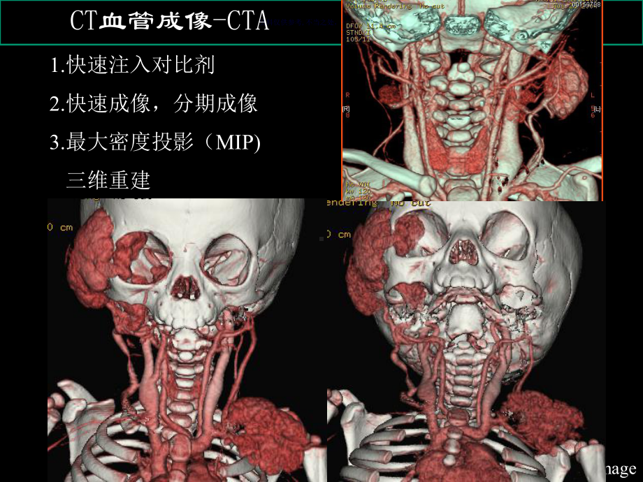 CTMR在儿科的应用课件.ppt_第2页