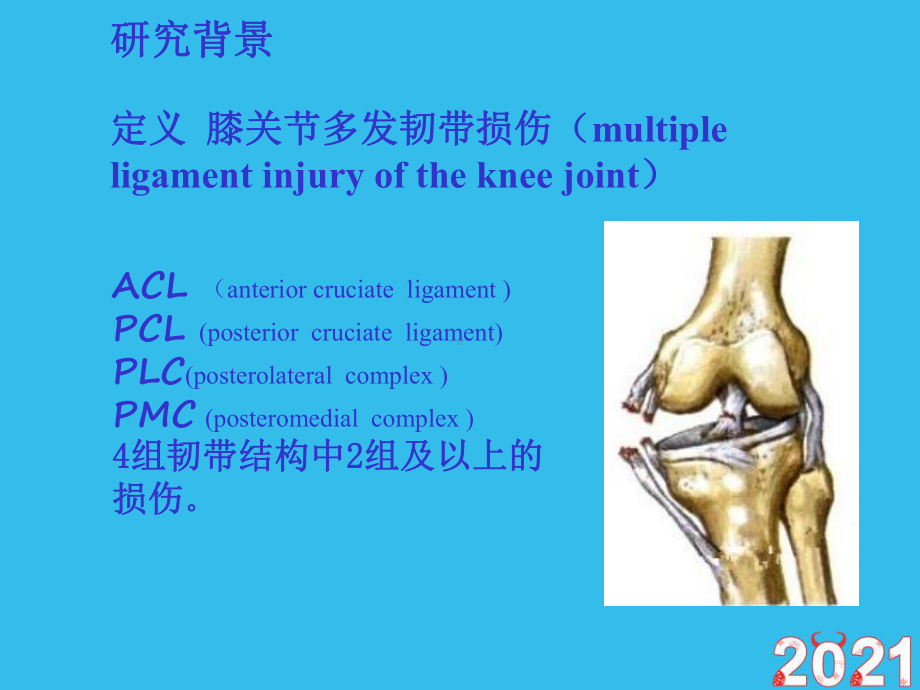 关节镜膝关节多发韧带损伤的修复(正式版文档)ppt课件.pptx_第3页