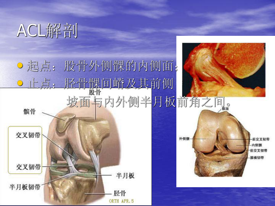 前交叉韧带概要PPT讲稿课件.ppt_第3页