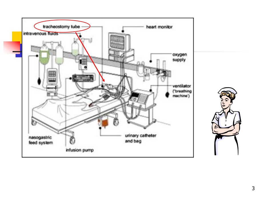 人工气道的管理PPT课件.ppt_第3页