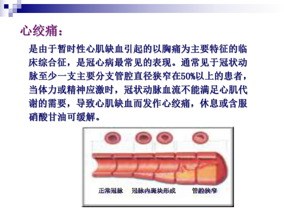 冠心病社区健康管理服务规范课件.ppt_第2页