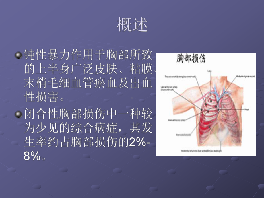 创伤性窒息课件.ppt_第2页