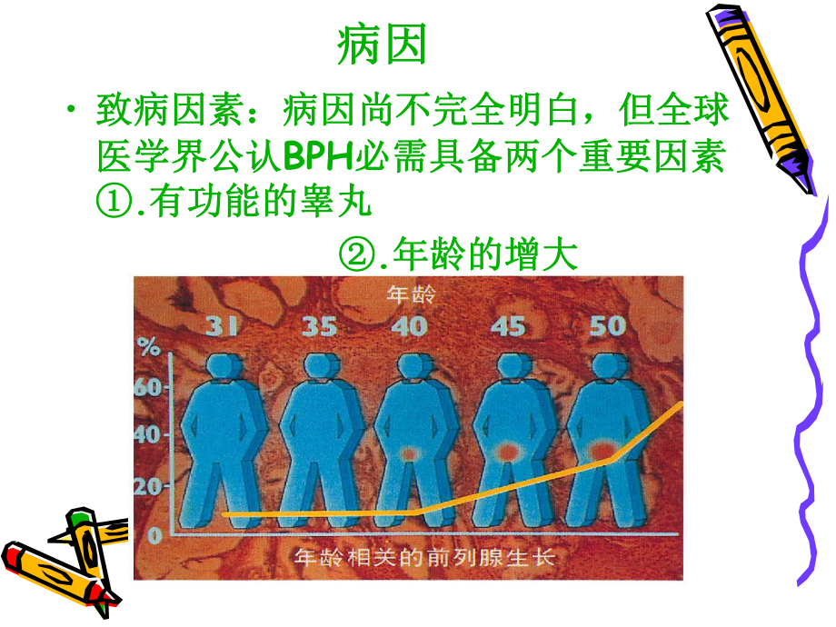 前列腺增生的护理课件.ppt_第2页