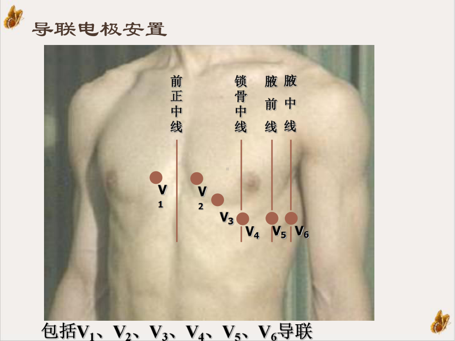 临床心电图规范化培训课件.ppt_第2页