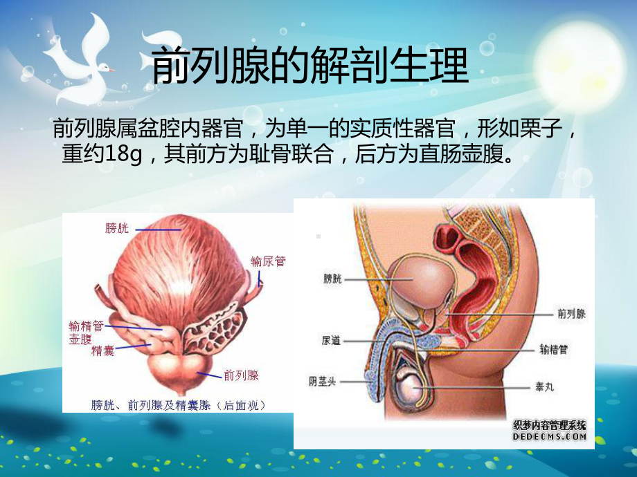 前列腺癌护理课件.ppt_第1页