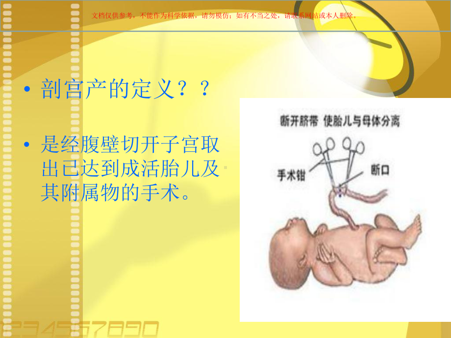 剖宫产医学知识课件.ppt_第1页