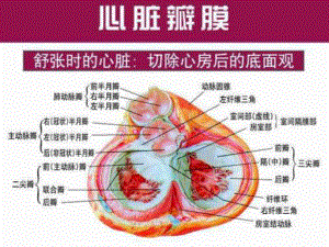 主动脉瓣狭窄课件.ppt