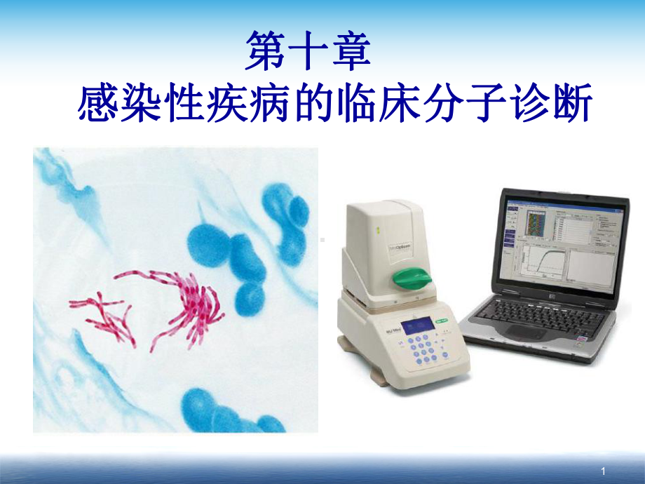 临床分子诊断学：第十章-感染性疾病的分子生物学检验课件.ppt_第1页