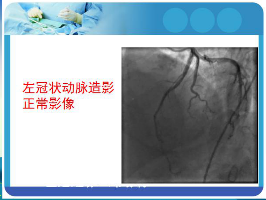 冠状动脉造影术后护理课件.ppt_第2页