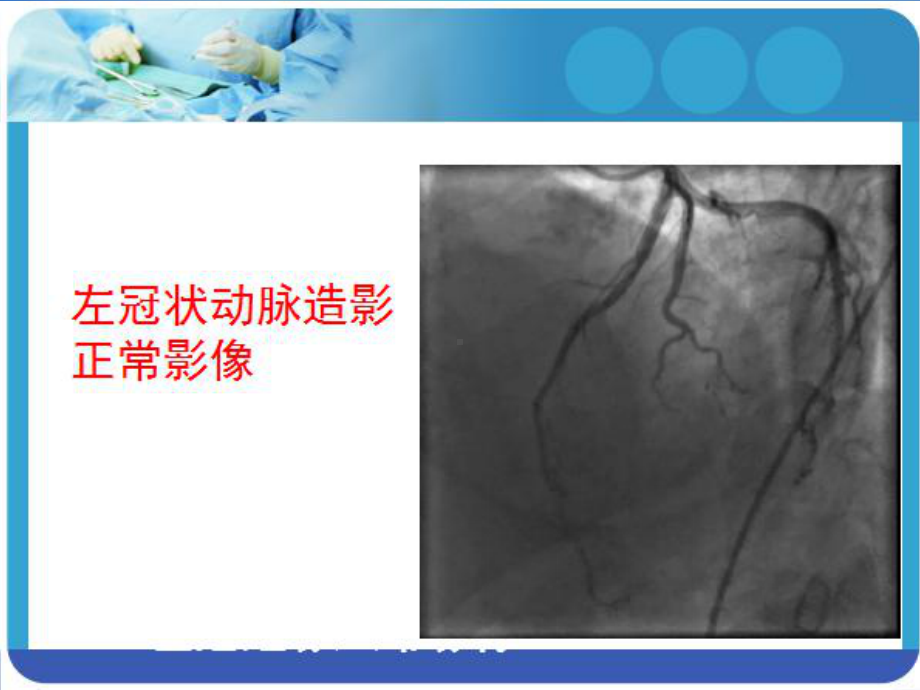 冠状动脉造影术后护理课件.ppt_第3页