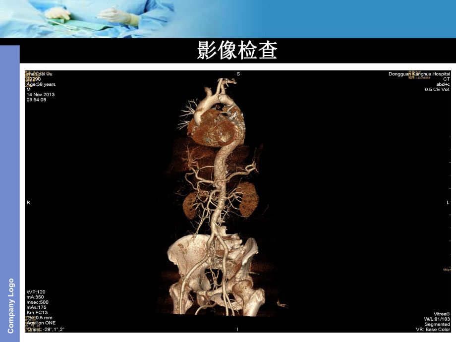 主动脉夹层教学查房课件 (2).ppt_第3页