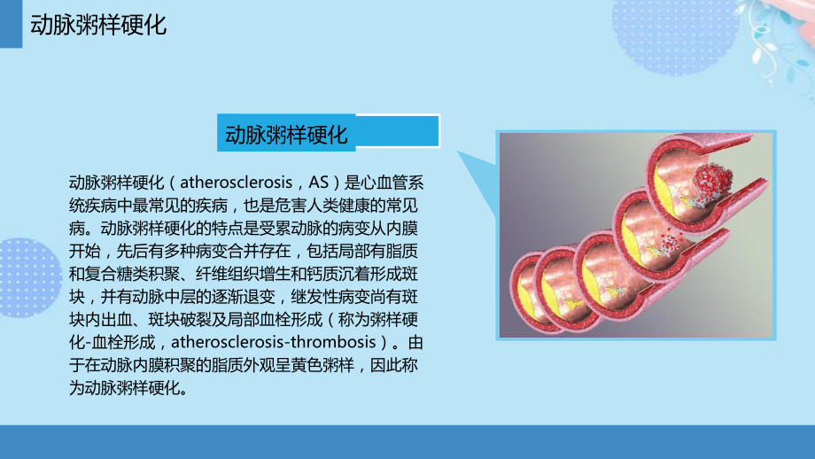 动脉粥样硬化PPT资料(完整版)课件.pptx_第3页