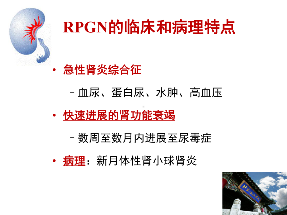 内科学大课及巡检：急进性肾小球肾炎课件.pptx_第2页