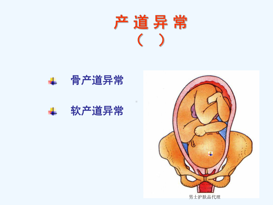 产道异常的分类和临床表现课件.ppt_第2页