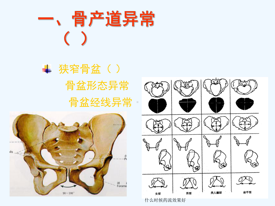 产道异常的分类和临床表现课件.ppt_第3页