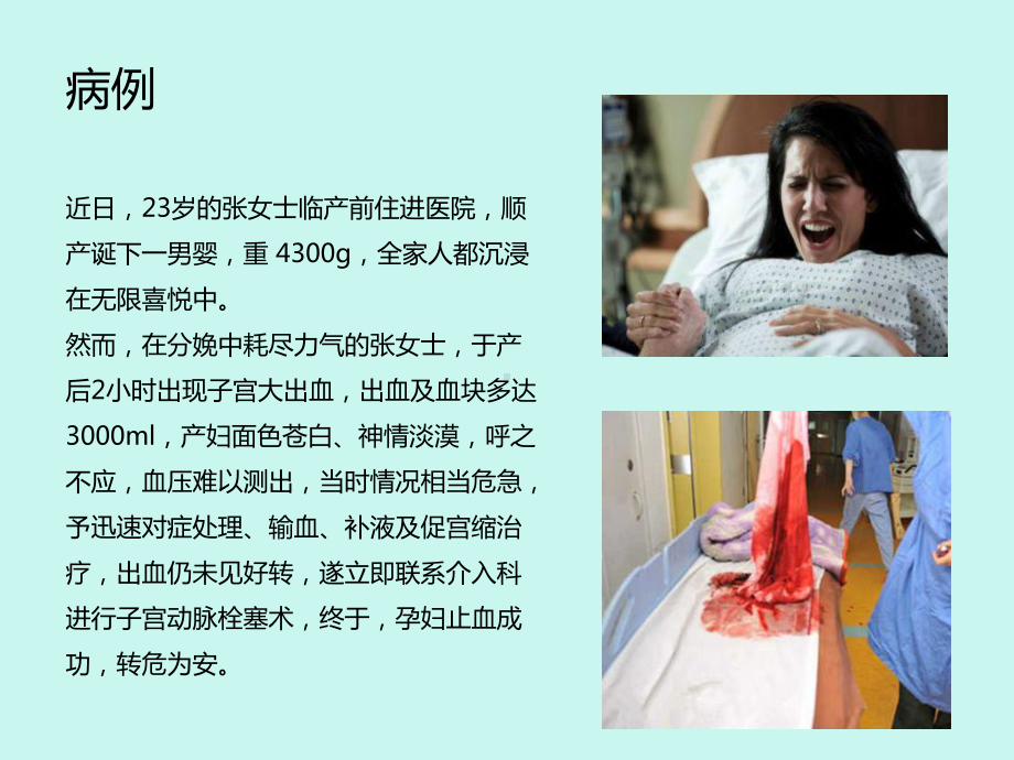 产后出血教学版课件.ppt_第1页