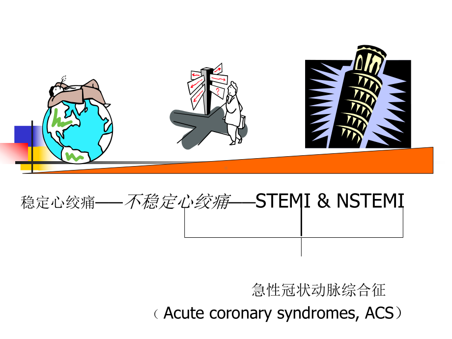 冠心病诊断流程和治疗选择课件.ppt_第3页