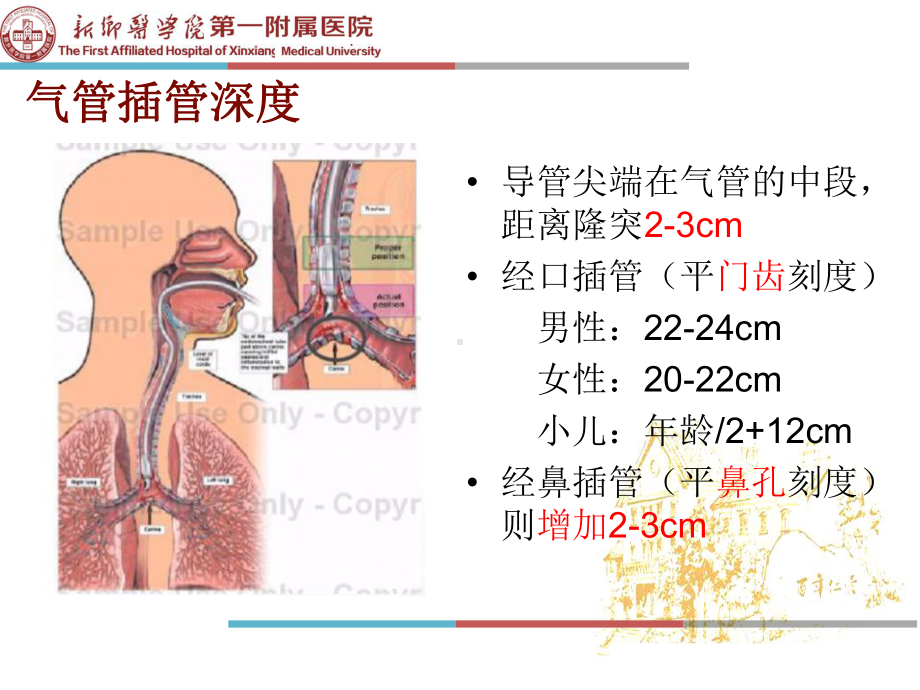 医学气管插管内吸痰技术PPT培训课件.ppt_第3页