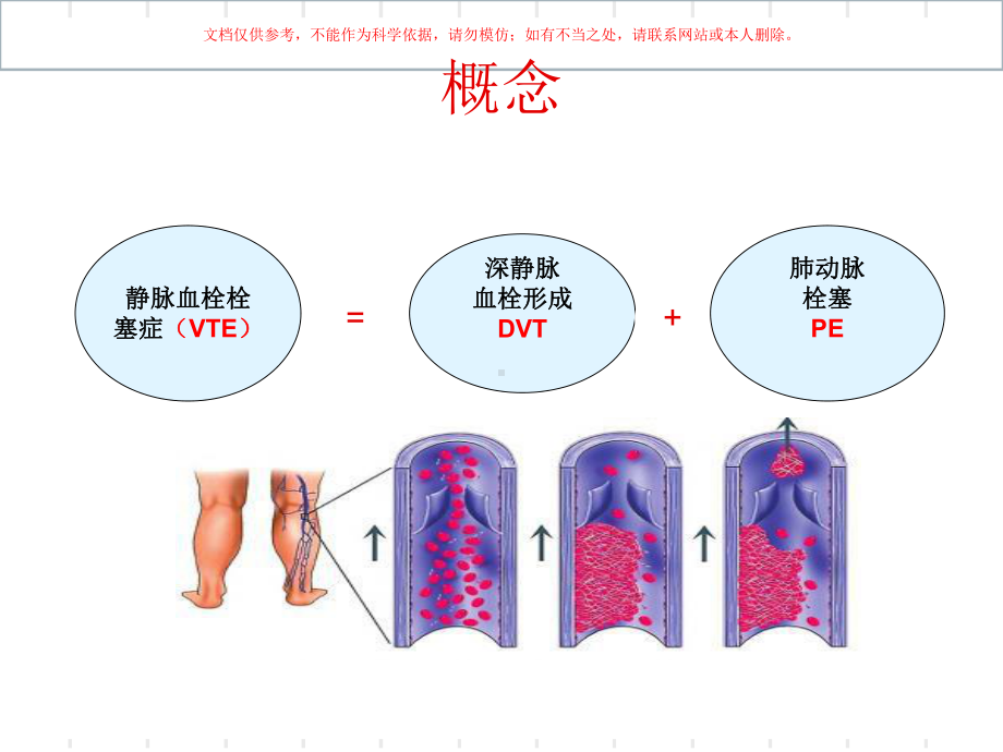 住院患者VTE评估课件.ppt_第3页