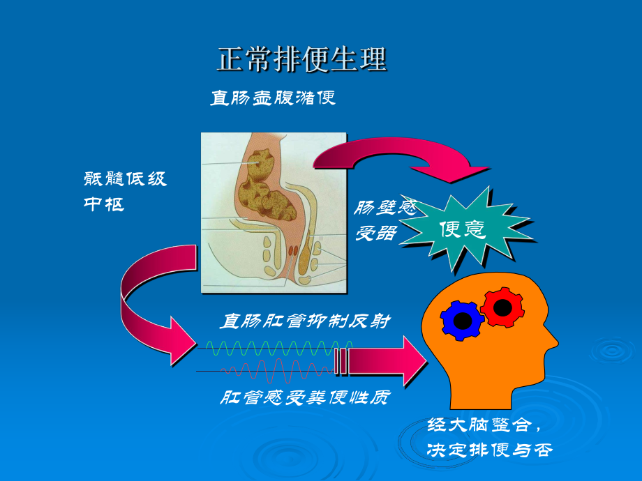 先天性巨结肠儿科学课件.ppt_第2页