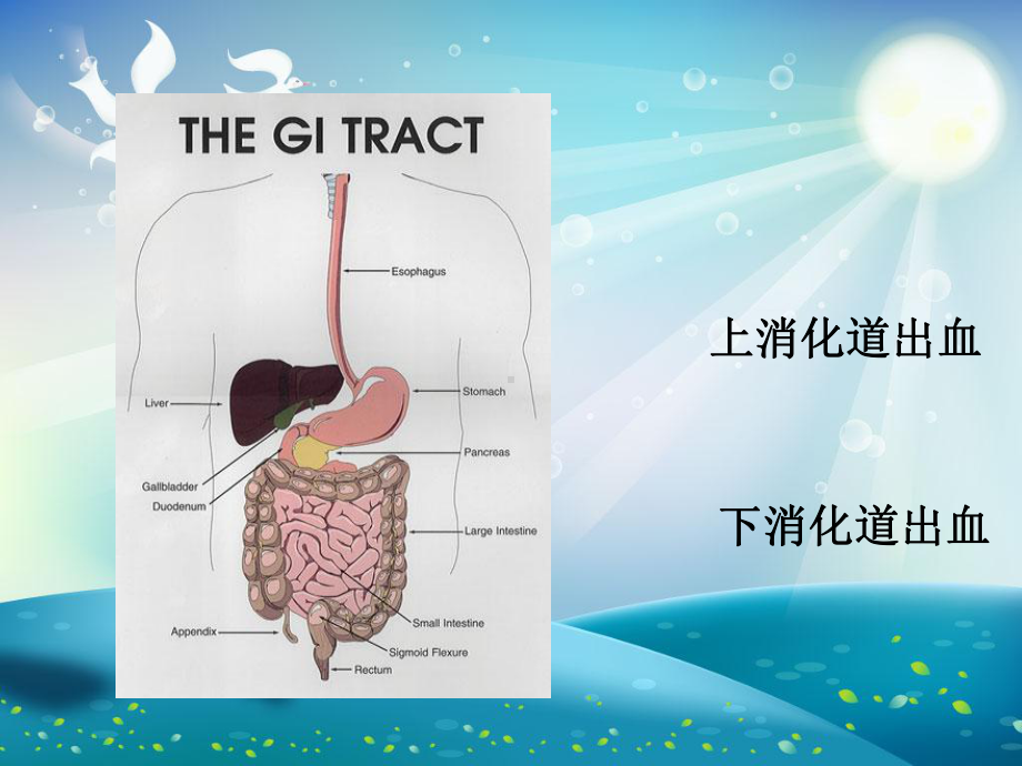 上消化道大出血的护理课件.ppt_第2页