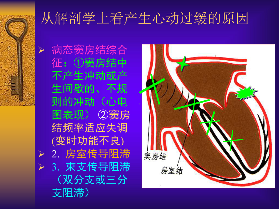 医学医疗心脏起搏器简述PPT培训课件.ppt_第3页