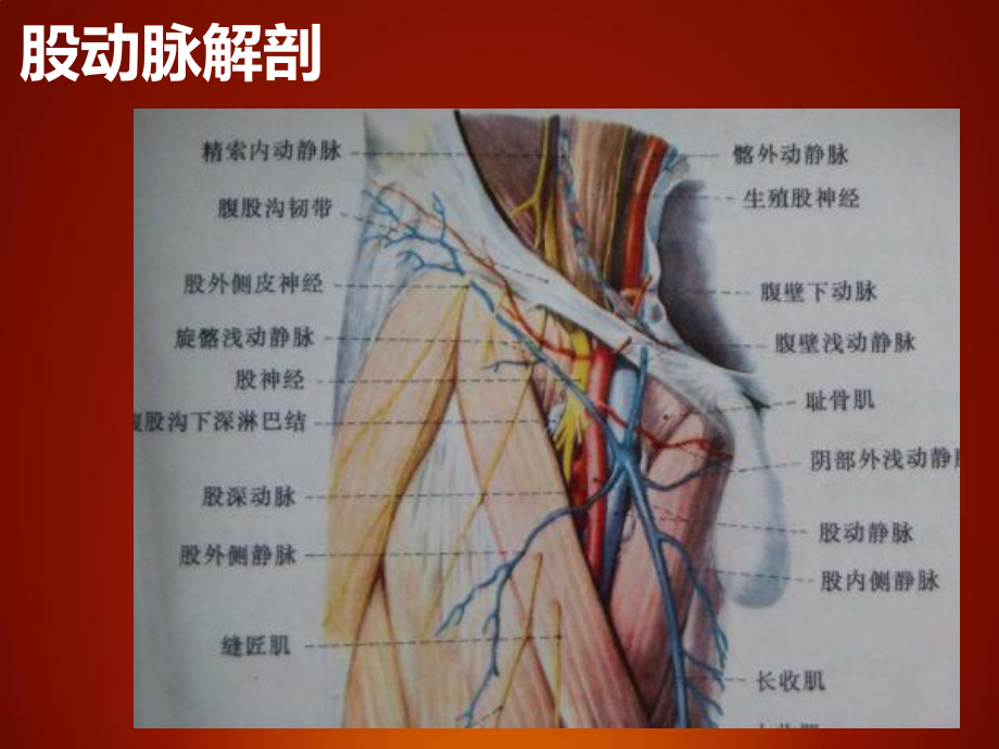 介入股动脉穿刺术PPT课件.ppt_第3页