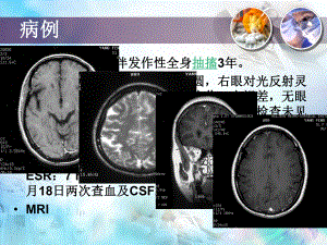 医学：8、囊虫病PPT课件.ppt