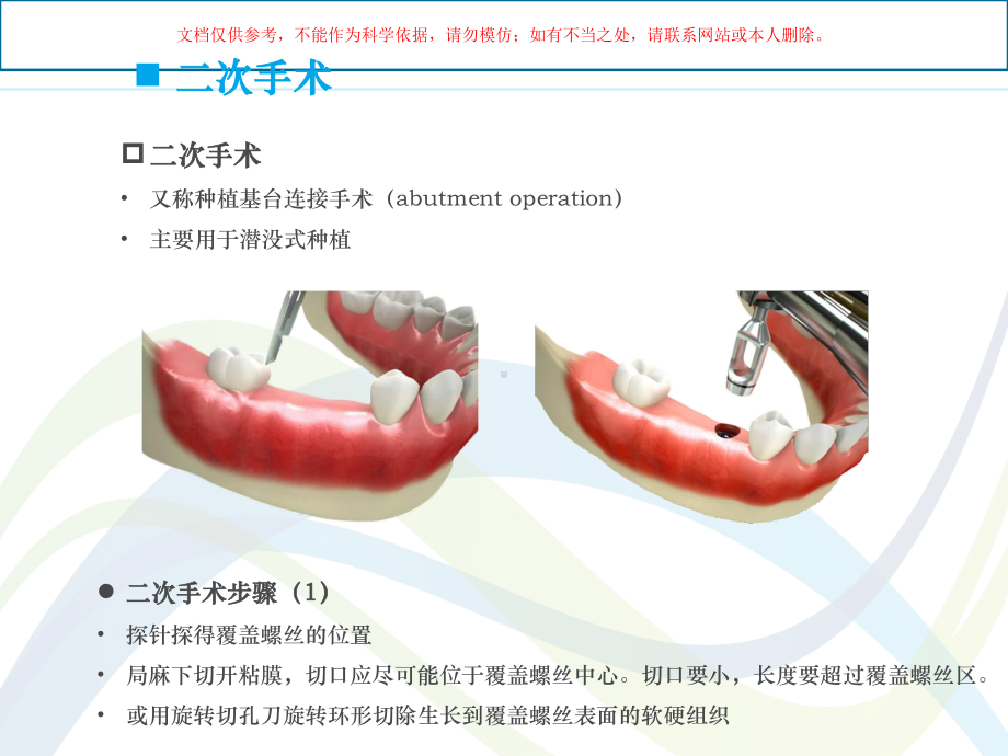 口腔种植修复培训课件.ppt_第3页