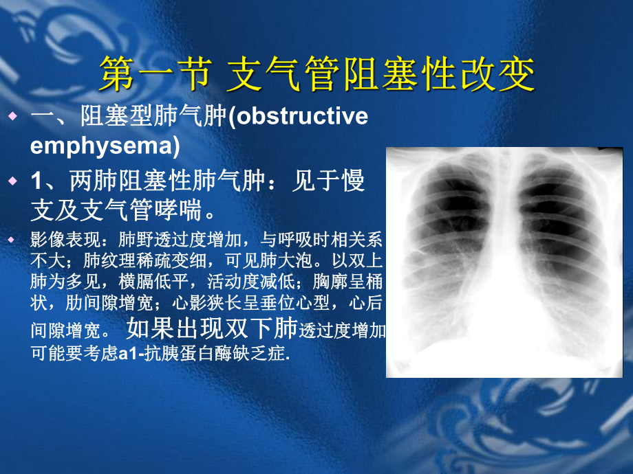 呼吸系统常见病变的影像学表现PPT课件.ppt_第3页