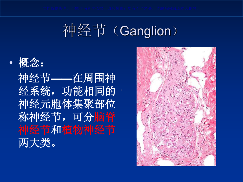 嗜铬细胞瘤影像课件.ppt_第2页