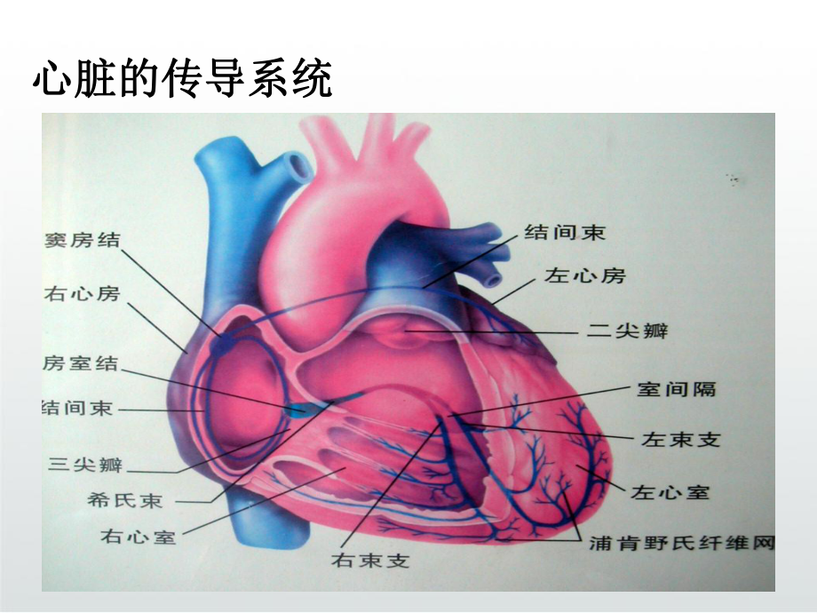 常见心律失常识别护理PPT课件.ppt_第3页