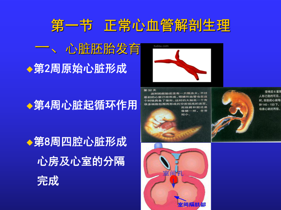 医学课件先天性心脏病专题医疗讲座.ppt_第2页