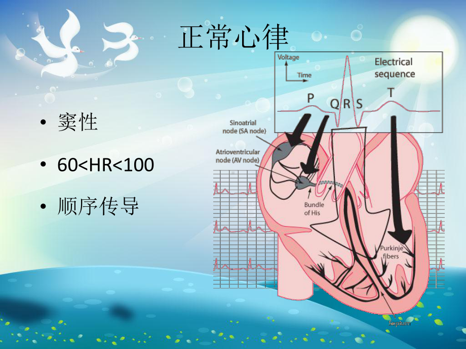 常见心律失常的识别与处理课件.ppt_第2页