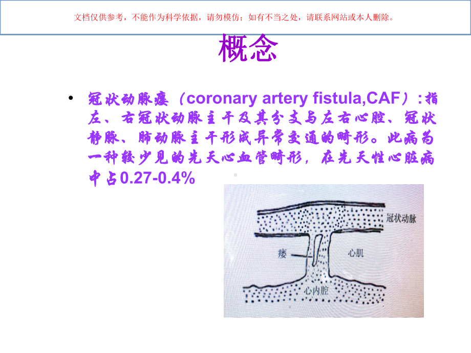 先天性冠状动脉瘘课件.ppt_第1页