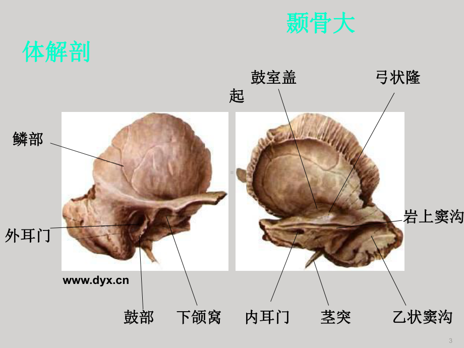 医学颞骨断层解剖和CT三维重建PPT培训课件.ppt_第3页