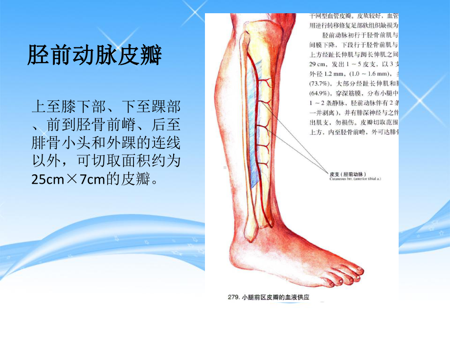 小腿前部皮瓣PPT培训课件.ppt_第3页