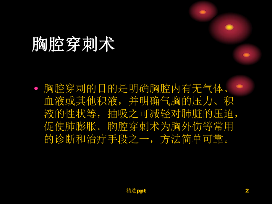 《胸腔穿刺术》PPT课件.ppt_第2页