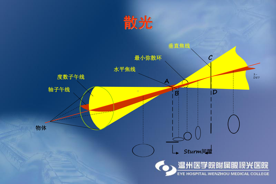 医学教学课件：散光硬性角膜接触镜.ppt_第3页