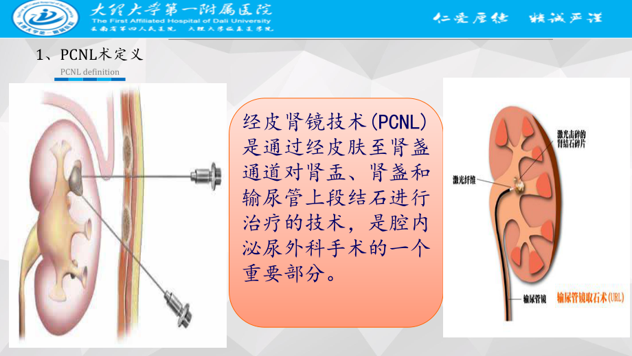 医学课件PCNL术围手术期护理.ppt_第3页