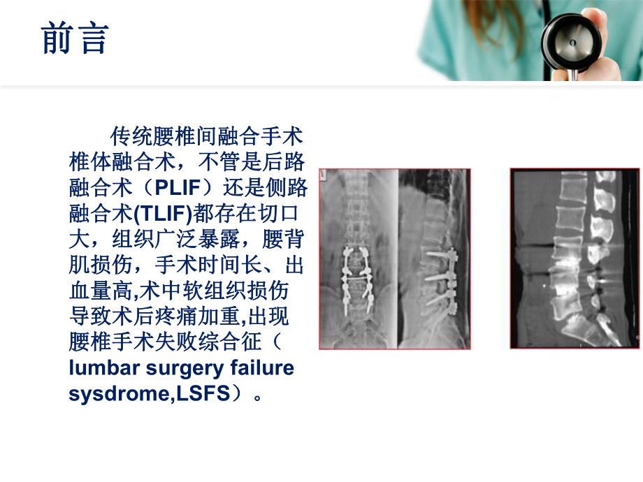 医学经皮腰椎融合术专题PPT培训课件.ppt_第3页