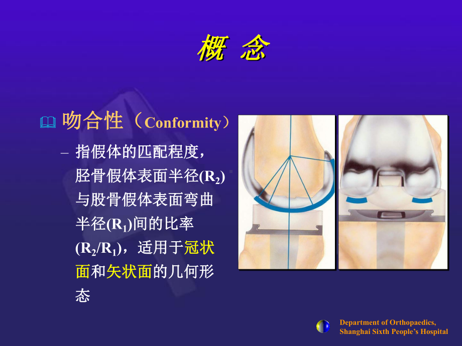 医学课件全膝关节假体设计和选择.ppt_第2页