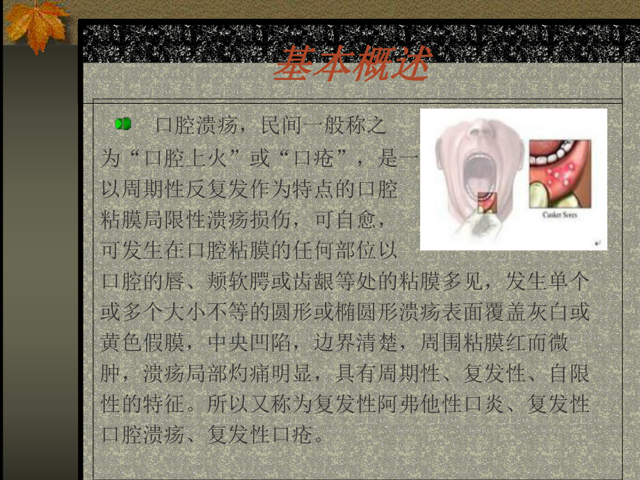 口腔溃疡专业知识宣讲PPT培训课件.ppt_第2页