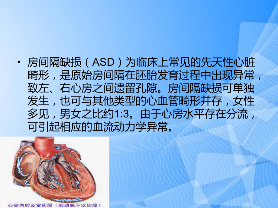 房间隔缺损护理查房PPT.ppt_第2页