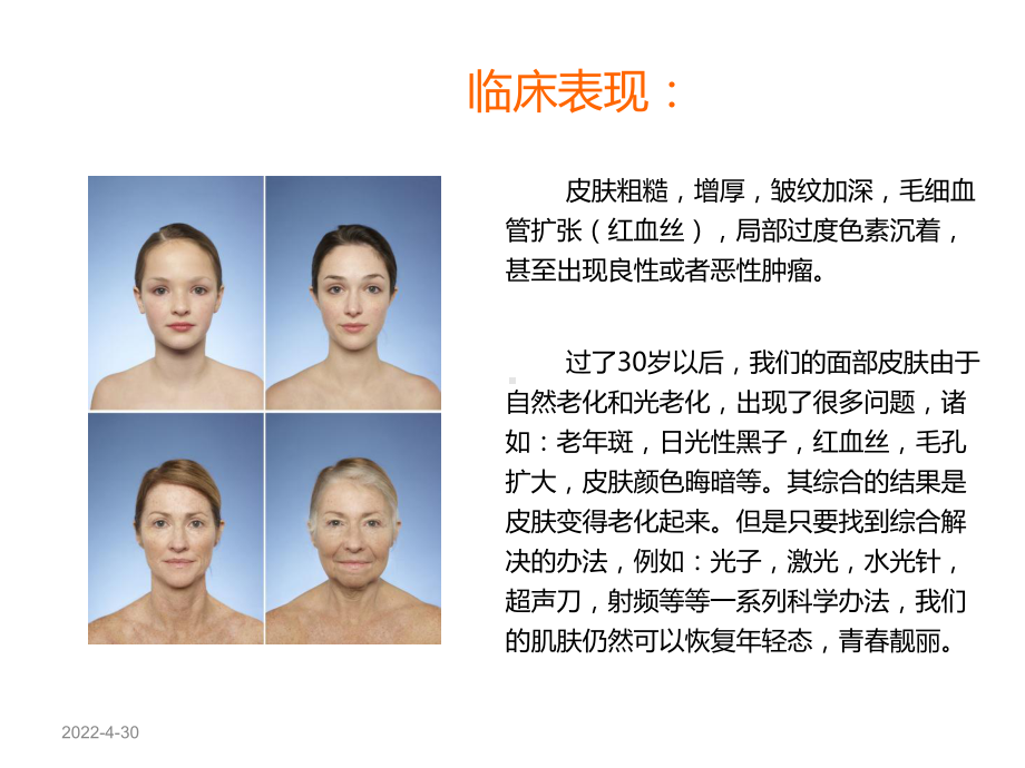 常见损容性皮肤疾病课件.ppt_第3页