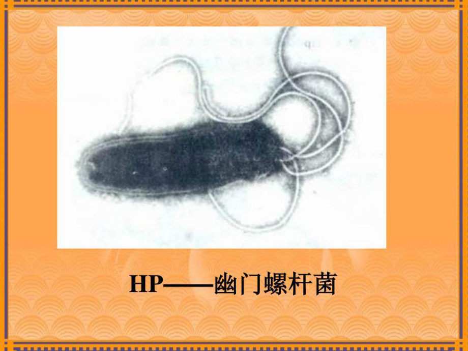 幽门螺旋杆菌新认识与治疗ppt课件共36页.ppt_第3页